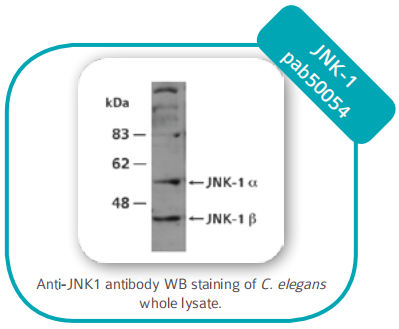 Enzyme-linked immunosorbent assay 酶联免疫吸附测定 